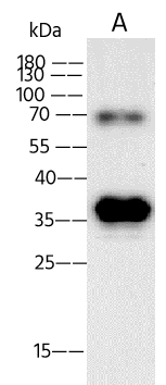 Monkeypox Virus E8L Antibody (16) - Azide and BSA Free