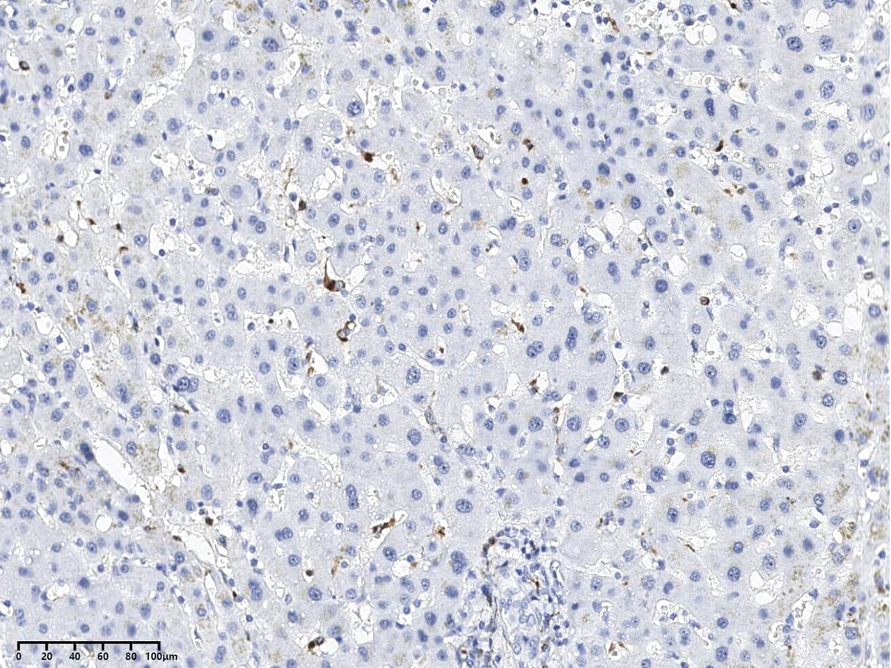Lysozyme Antibody (095) - Azide and BSA Free