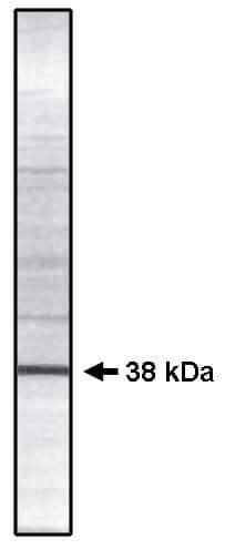 Protein Phosphatase 1C gamma Antibody