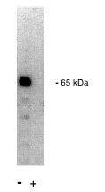 PPP2R1A Antibody