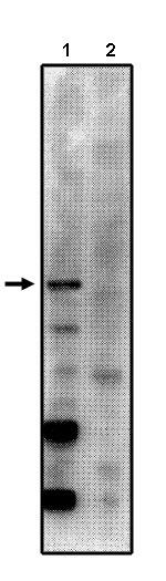 PPP2R5C Antibody