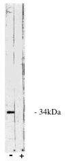 PP4/PPP4C Antibody