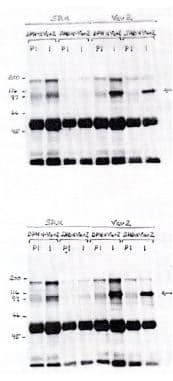 VAV2 Antibody