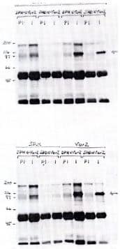 VAV2 Antibody (Polyclonal)