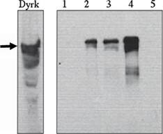 DYRK1A Antibody