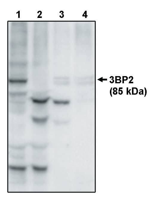 SH3BP2 Antibody