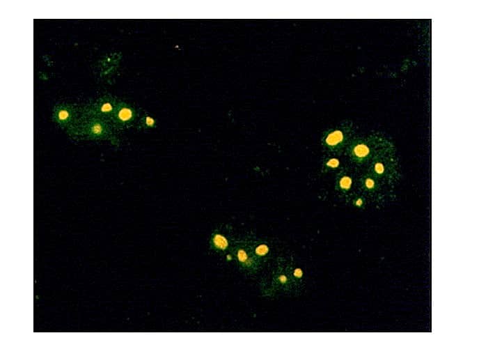 FDPS Antibody