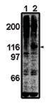 FAK Antibody