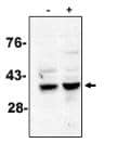 Caspase-7 Antibody (MCH3-5)