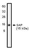 SH2D1A Antibody