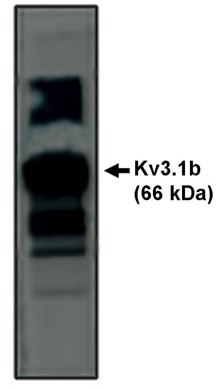 Potassium Channel Kv3.1 Antibody