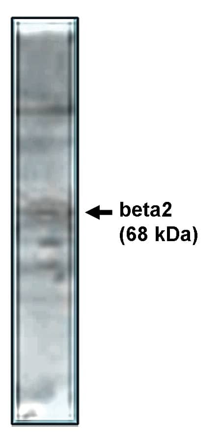 CACNB2 Antibody