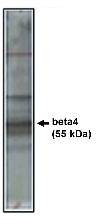 CACNB4 Antibody