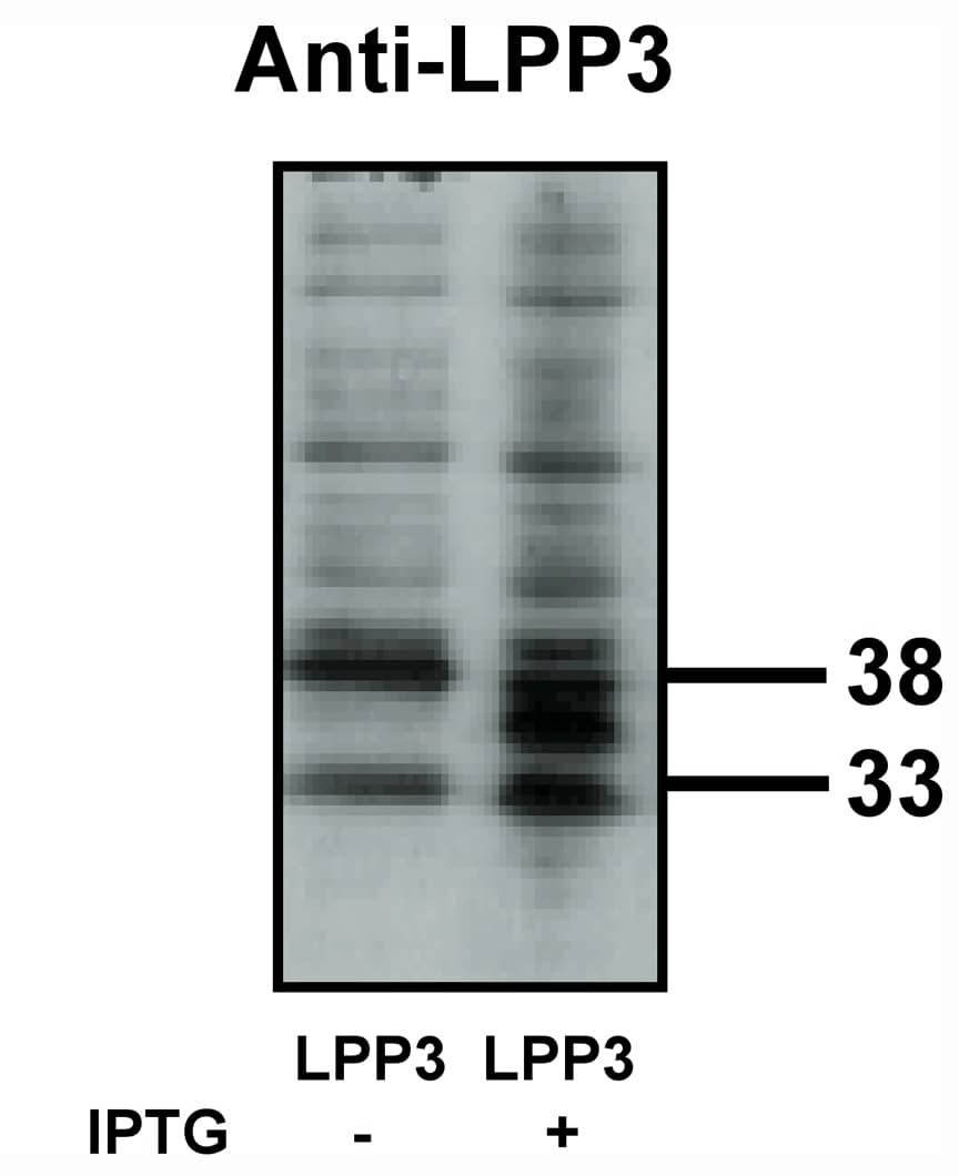 PPAP2B Antibody