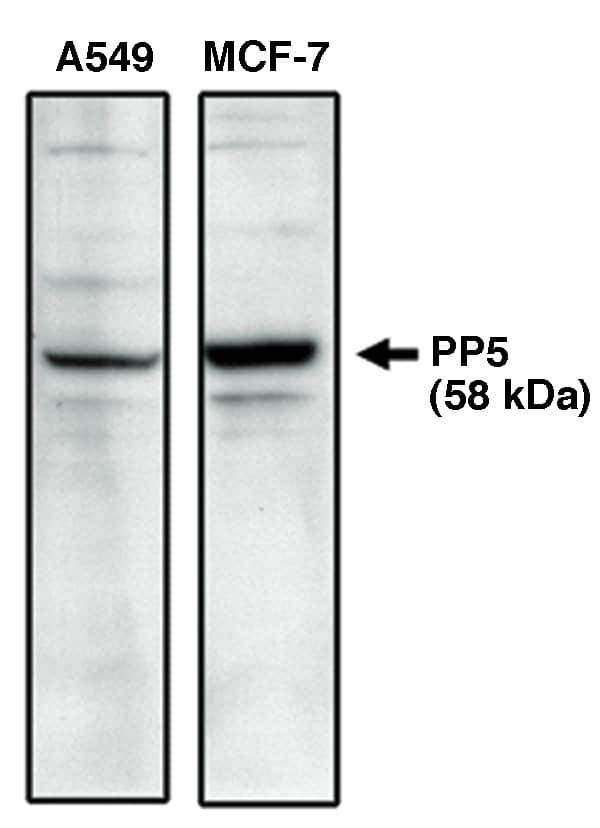 PP5 Antibody