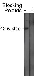 Sphingosine Kinase 1/SPHK1 Antibody