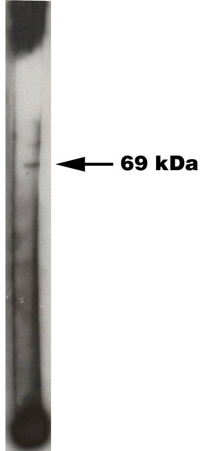 Sphingosine Kinase 2/SPHK2 Antibody