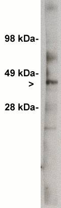 UGCG Antibody