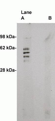 Sphingomyelin Synthase 2 Antibody