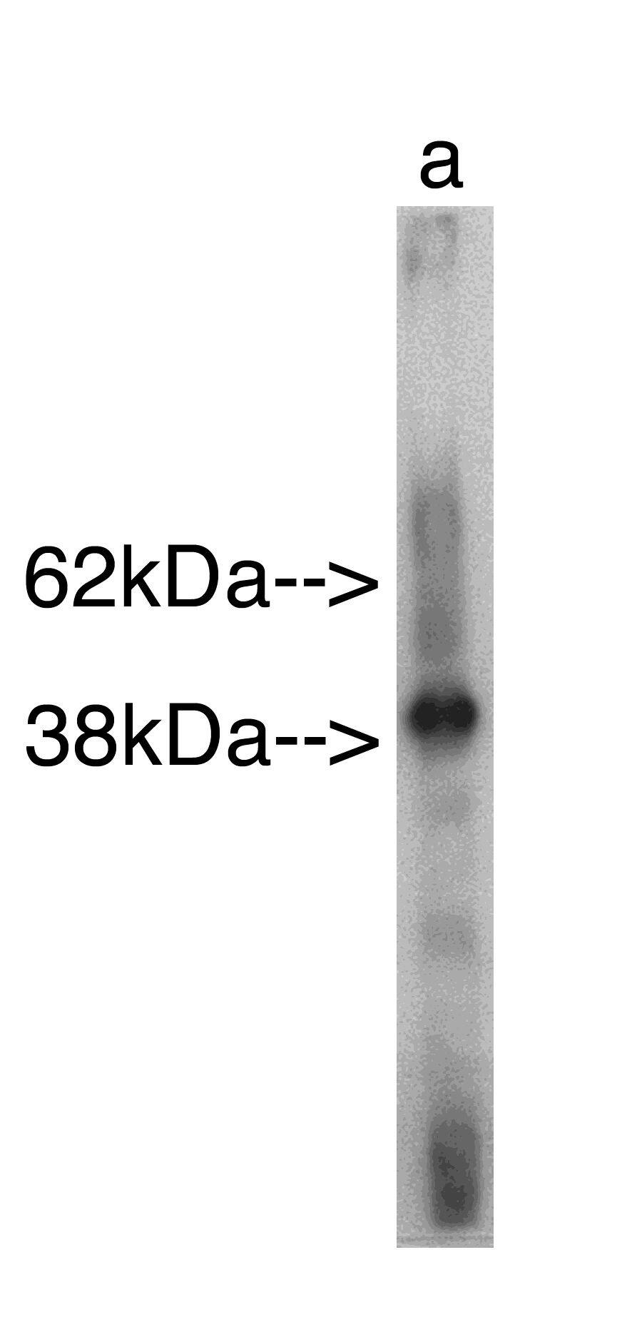 SAMD8 Antibody