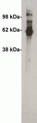 Ceramide Kinase Antibody