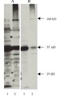 Nitrotyrosine Antibody (2A12)