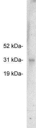 FHL2 Antibody