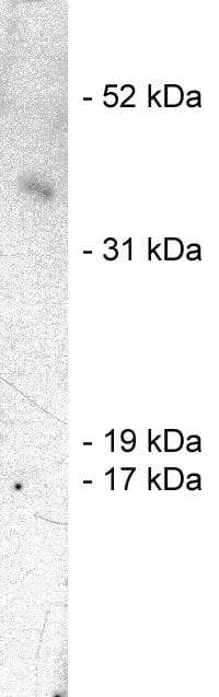 SIAH1 Antibody