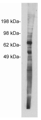 Netrin-1 Antibody