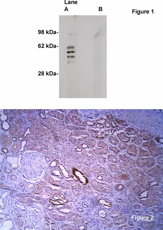 Sphingomyelin Synthase 2 Antibody