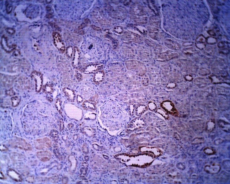 Sphingomyelin synthase 1 Antibody