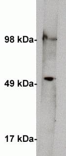 SPTLC1 Antibody