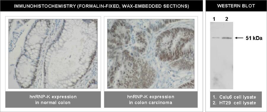 hnRNP K Antibody (F45 P9 C7)