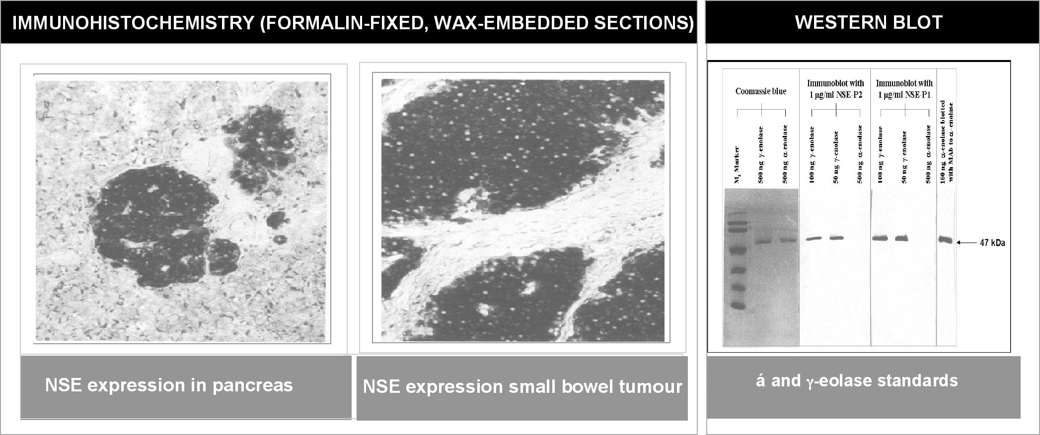 Enolase 2/Neuron-specific Enolase Antibody (NSE-P1)