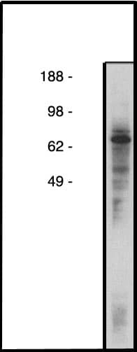 COL4A3BP Antibody