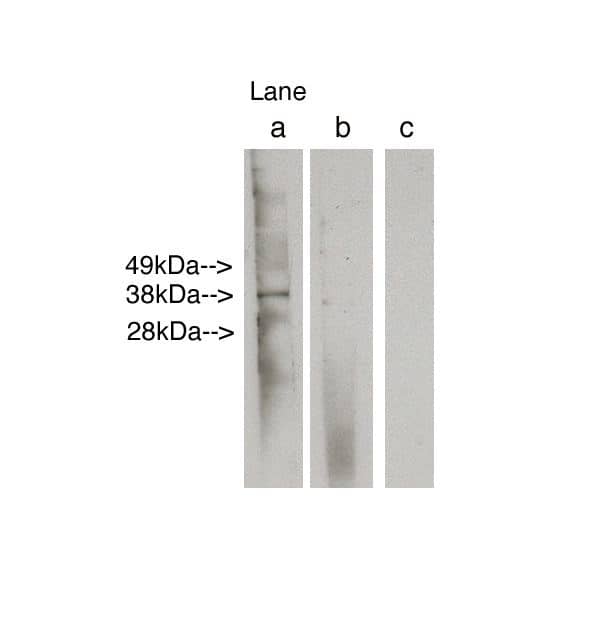 LASS6 Antibody