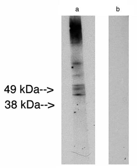 LASS2 Antibody