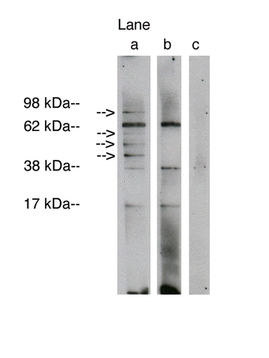 LASS1 Antibody