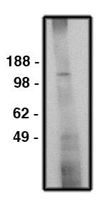 NHE6/SLC9A6 Antibody