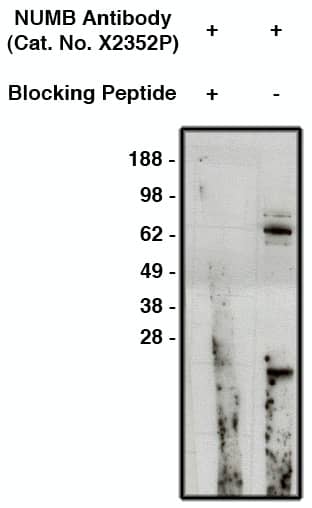 Numb Antibody