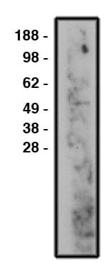 COL4A3BP Antibody