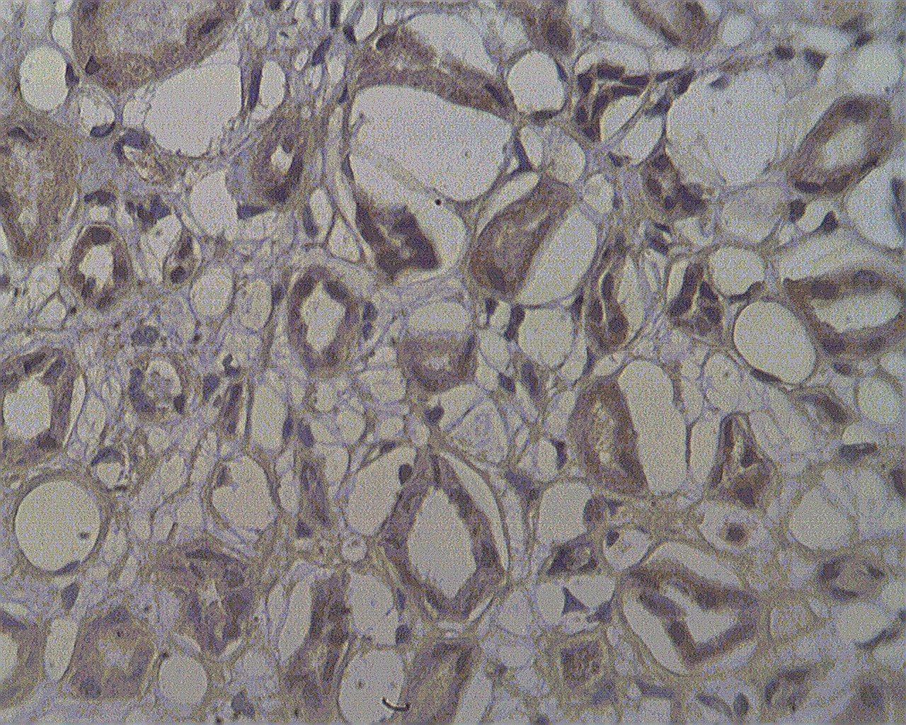 NOL4 Antibody