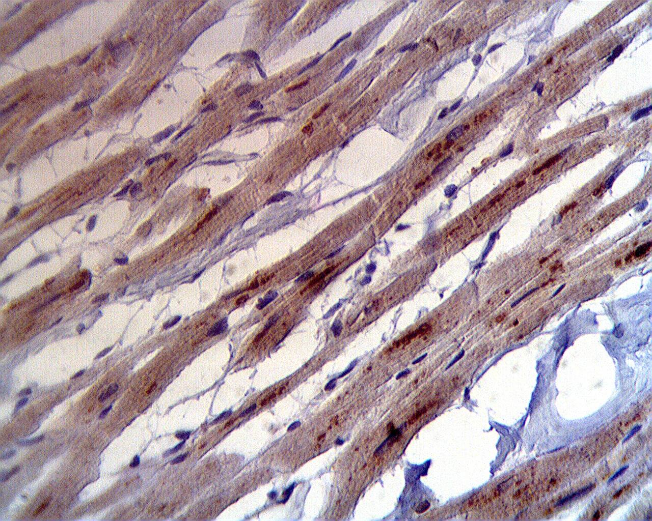 ASAH1 Antibody