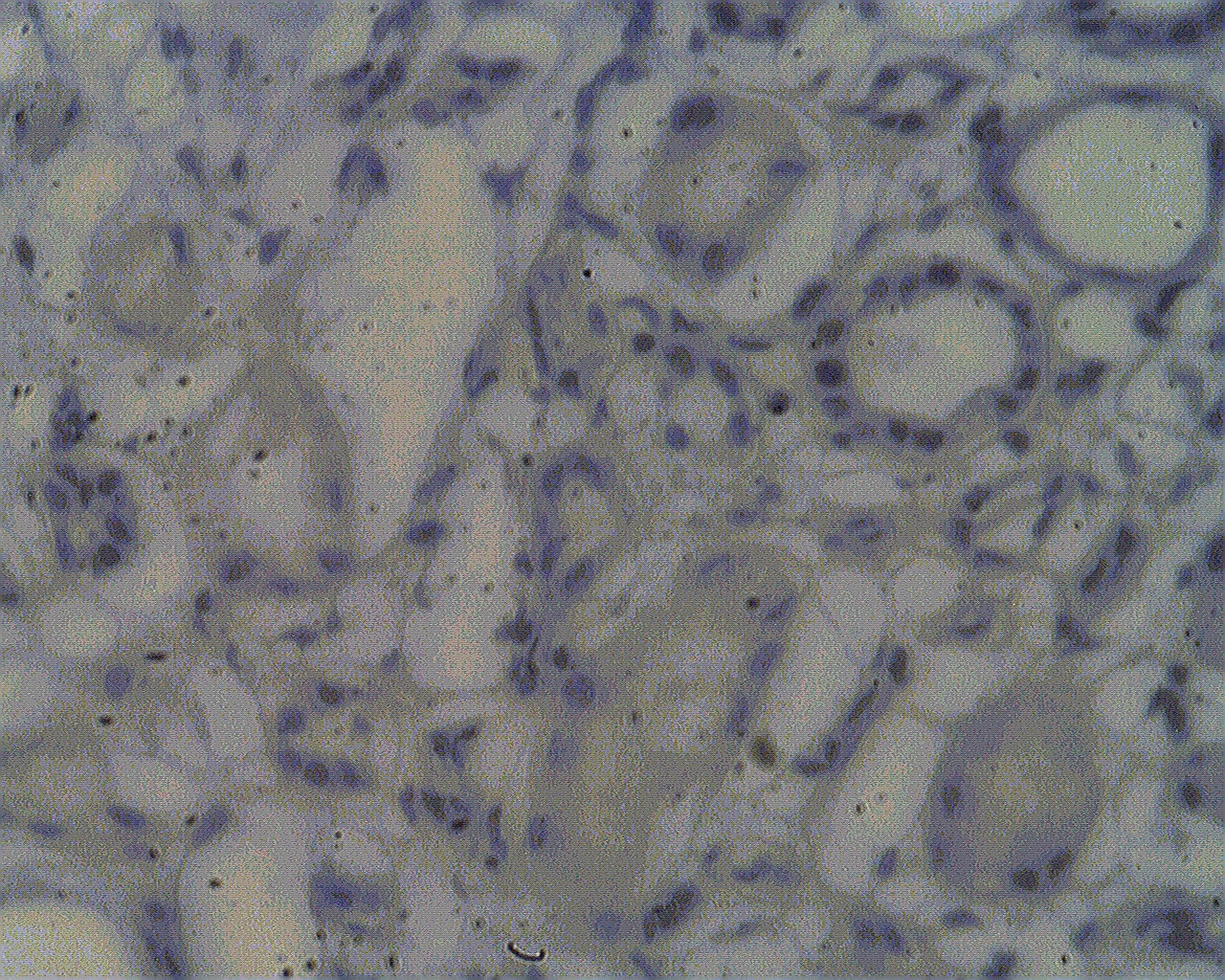 NOL4 Antibody