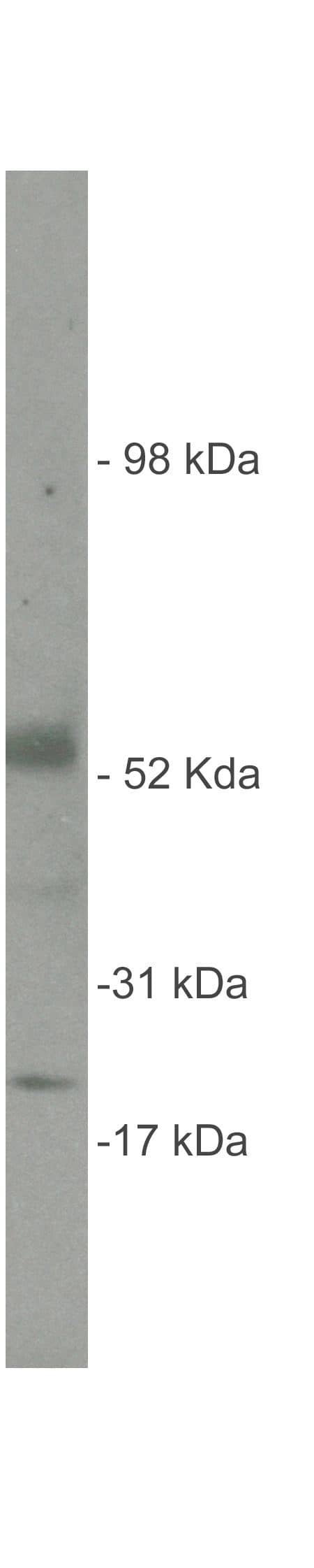 Sulfatase-2/SULF2 Antibody