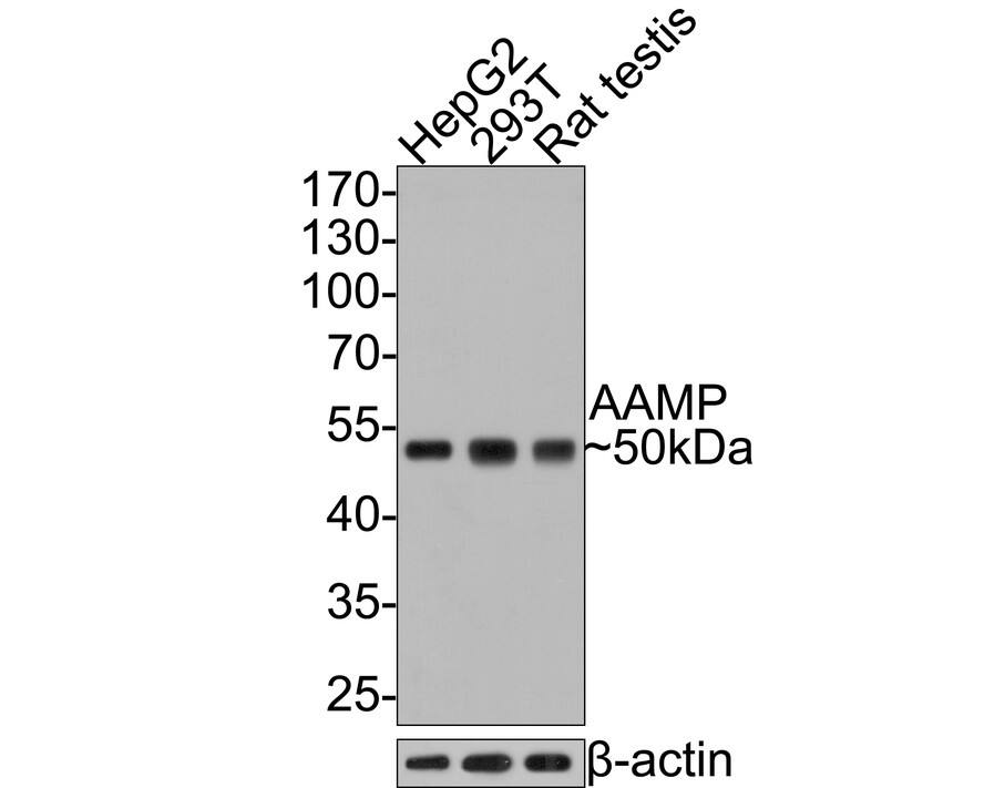 AAMP Antibody (JE64-70)