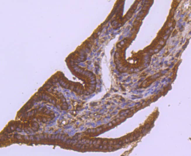 ABCG2/CD338 Antibody (JF0994)