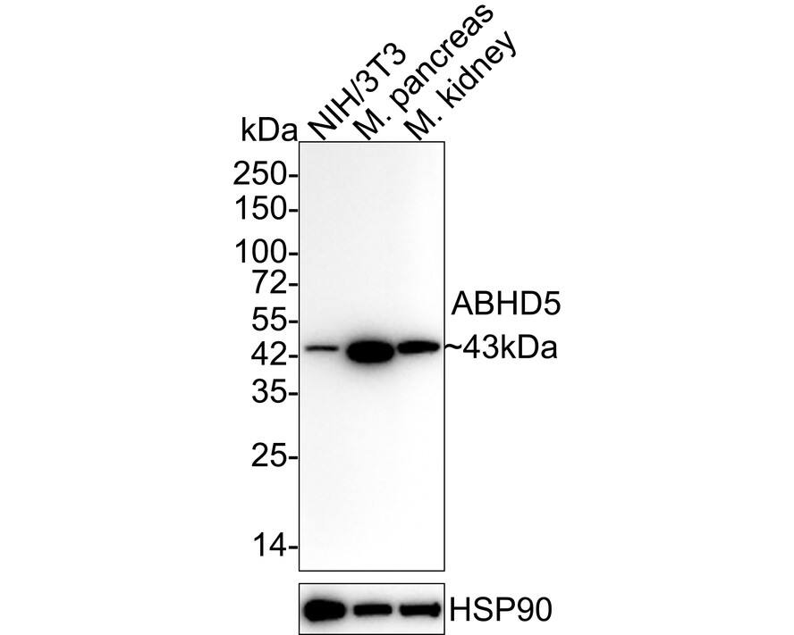 Abhd5 Antibody (JE60-62)