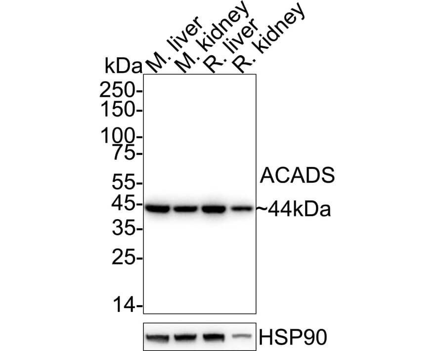 ACADS Antibody (JE64-13) Western Blot: ACADS Antibody (JE64-13) [NBP3-31991]