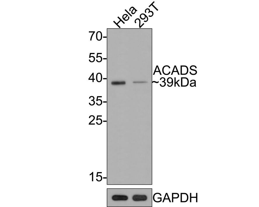 ACADS Antibody (JE64-13)